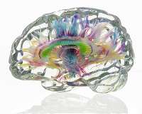 A multimaterial, voxel-printing method turns imaging datasets into physical objects