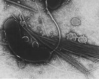 Cyclone-ravaged Mozambique reports five cholera cases