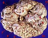 Ancient brain tissue found in Britain