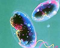 Northern Iraq battles cholera 'epidemic'
