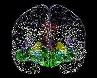 Study: Cognitive ability is a whole-brain phenomenon