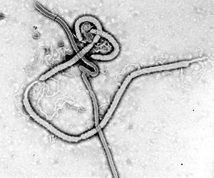 Highly lethal Ebola virus has diagnostic Achilles' heel for biothreat detection