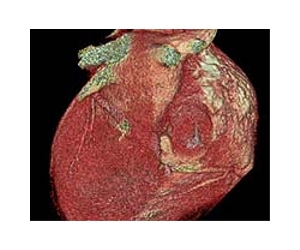 Heart-powered pacemaker could one day eliminate battery-replacement surgery