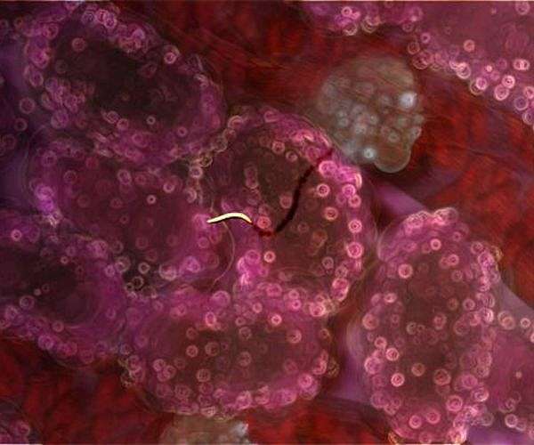 Malaria cases spike in Malawi, Pakistan after 'climate-driven' disasters