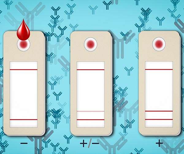 New test may predict Covid-19 immunity