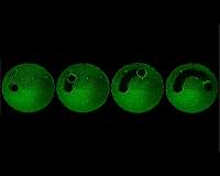 An army of micro-robots can wipe out dental plaque
