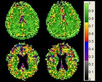 IBM acquires medical imaging firm to help Watson 'see'